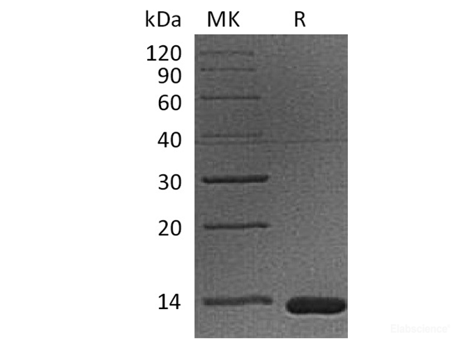 Recombinant Cynomolgus B2M / Beta-2-microglobulin Protein (C-His)-Elabscience