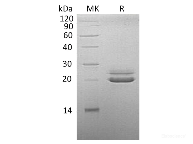 Recombinant Cynomolgus FGF-21 / Fibroblast Growth Factor 21 Protein (C-His)-Elabscience