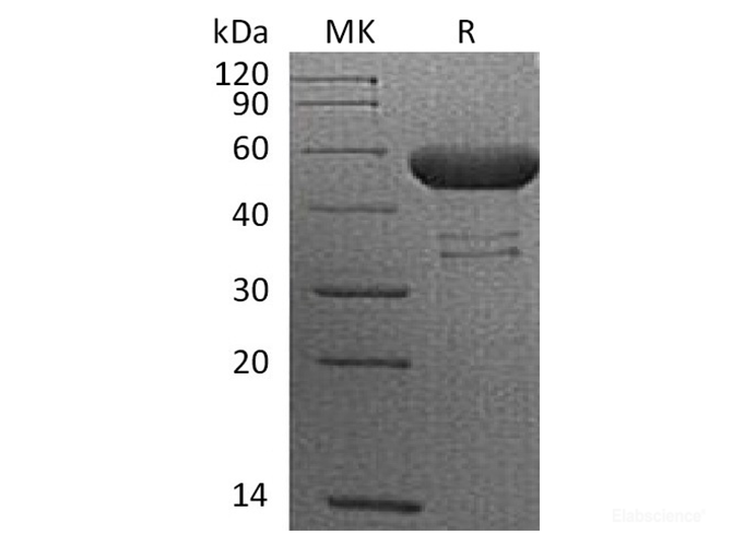 Recombinant Cynomolgus CTLA-4 / CD152 Protein (C-Fc)-Elabscience