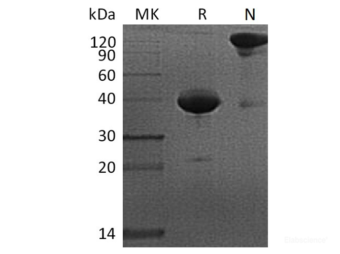 Recombinant Cynomolgus BCMA / TNFRSF17 / CD269 Protein (C-Fc)-Elabscience