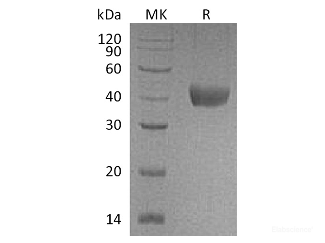 Recombinant Cynomolgus CD38 / ADP-ribosyl Cyclase 1 Protein (C-His)-Elabscience