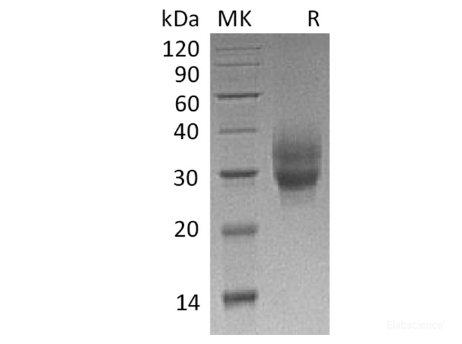 Recombinant Cynomolgus 4-1BB / TNFRSF9 / CD137 Protein (C-His)-Elabscience
