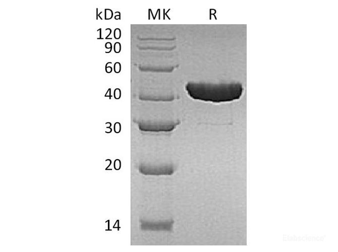 Recombinant E.coli Tryptophan Synthase β chain / Trp B Protein (N-His)-Elabscience