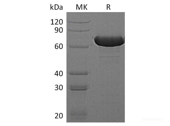 Recombinant E.coli Beta-Glucuronidase / Uida / Beta-Gus Protein (N-His)-Elabscience