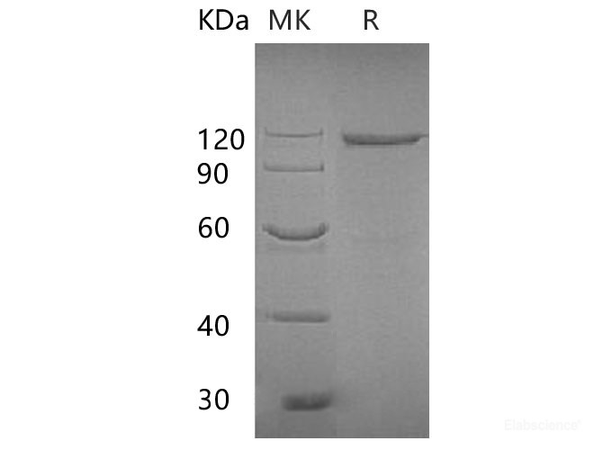 Recombinant E.coli Beta-galactosidase Protein(M443L, C500S) (C-Fc)-Elabscience