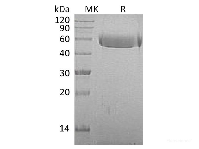 Recombinant Macaca mulatta AHSG / Fetuin A Protein (C-His)-Elabscience