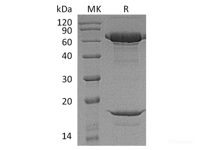Recombinant Macaca nemestrina PCSK9 / Proprotein Convertase 9 Protein (C-His)-Elabscience