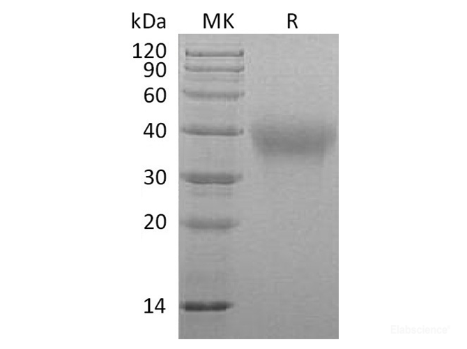 Recombinant Marmoset TIM-3 / HAVCR2 Protein (C-His)-Elabscience