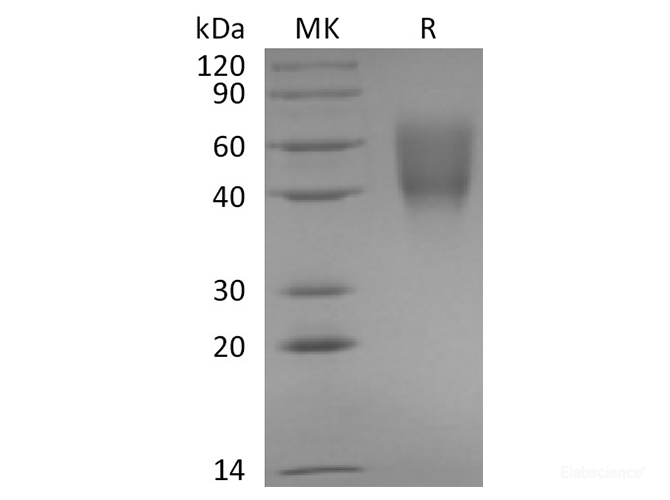 Recombinant Rabbit B7-2 / CD86 Protein (C-His)-Elabscience
