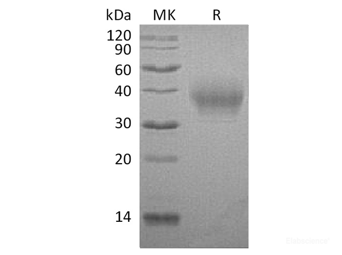 Recombinant Rabbit B7-1 / CD80 Protein (C-His)-Elabscience
