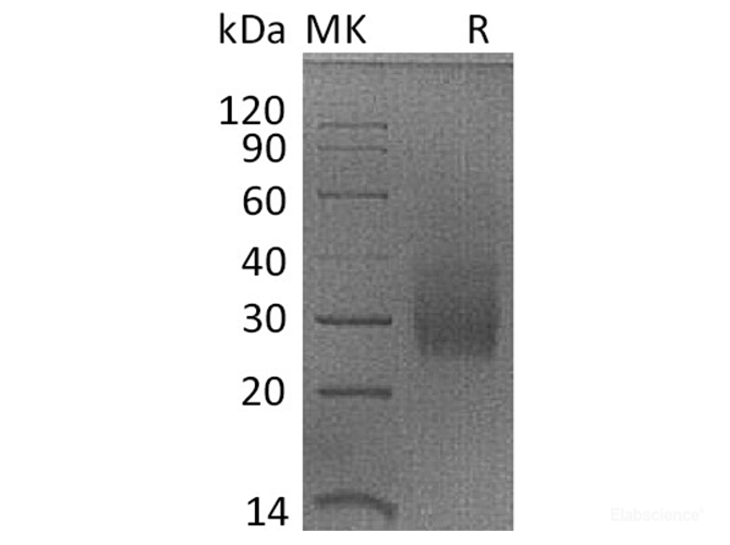 Recombinant Rhesus macaque HVEM / TNFRSF14 / CD270 Protein (C-His)-Elabscience