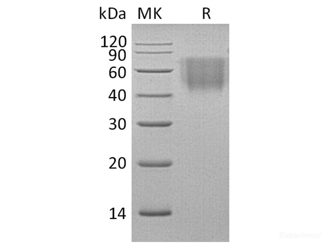 Recombinant Rhesus macaque B7-2 / CD86 Protein (C-His)-Elabscience