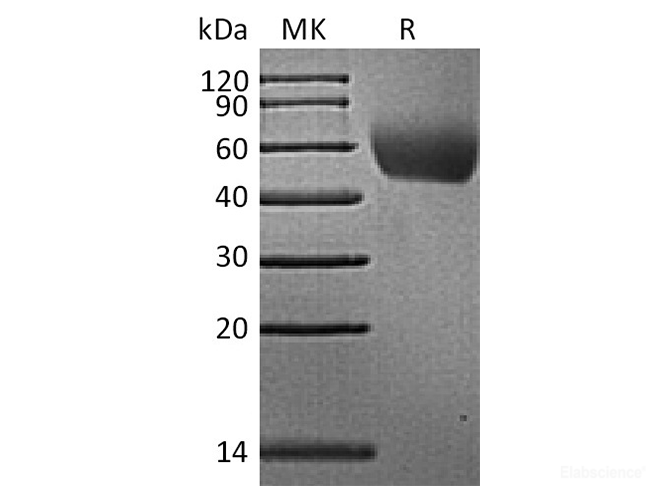 Recombinant Rhesus macaque CD155 / PVR / NECL5 Protein (C-His)-Elabscience