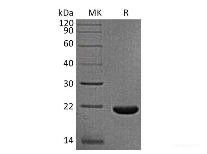 Recombinant Rhesus macaque IL-33 / Interleukin-33 Protein (N-His)-Elabscience