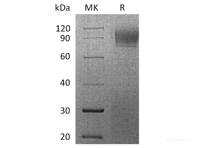 Recombinant Rhesus macaque IFNAR1 Protein (C-His)-Elabscience