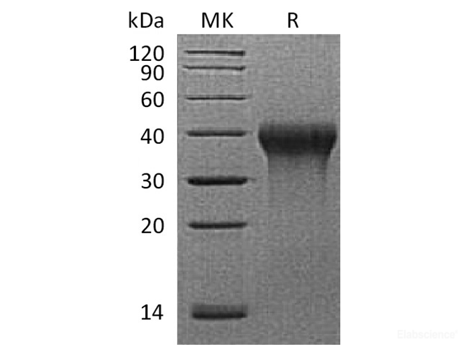 Recombinant Rhesus macaque CD27 / TNFRSF7 Protein (C-His)-Elabscience