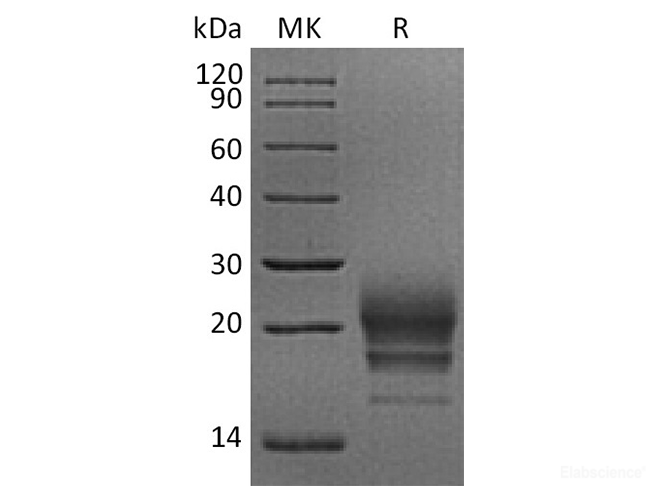 Recombinant Rhesus macaque CD160 Protein (C-His)-Elabscience
