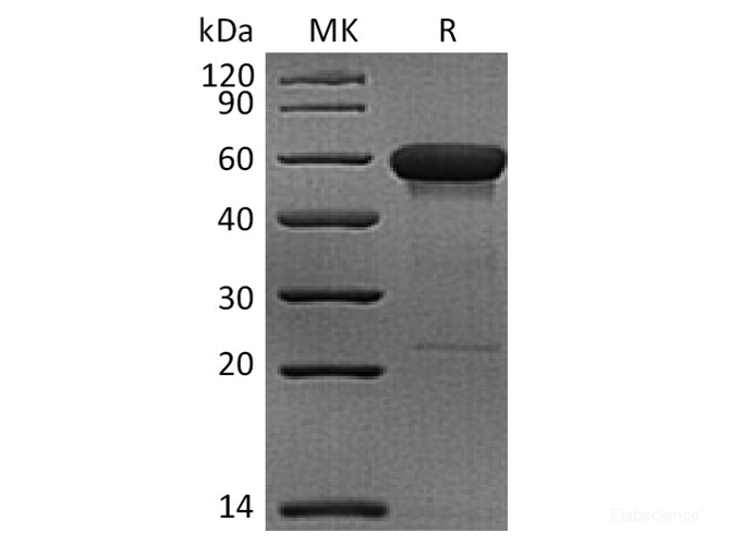 Recombinant Rhesus macaque CD160 Protein (C-Fc)-Elabscience