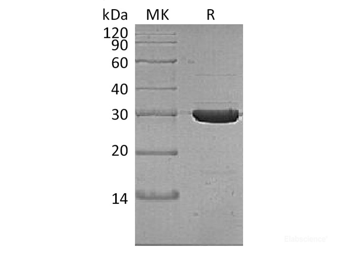 Recombinant Thermobifida fusca Cutinase Protein (C-His)-Elabscience