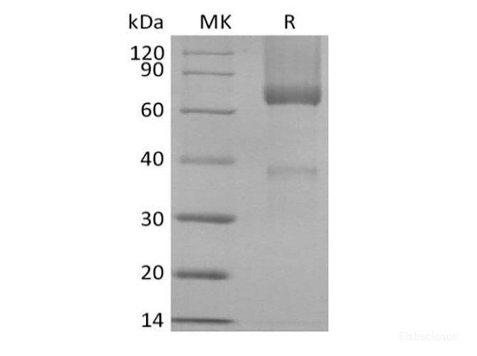Recombinant Rhesus Macaque Glypican-3/GPC3/OCI5 (C-6His)