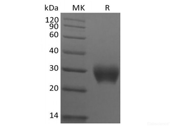 Recombinant Rhesus Macaque Leukocyte-associated Immunoglobulin-like Receptor 1/LAIR1/CD305 (C-6His)