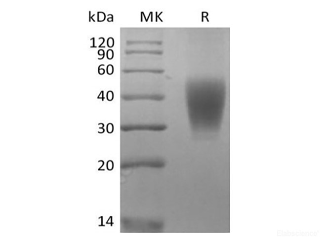 Recombinant Rhesus Macaque SLAM Family Member 7/SLAMF7/CD319/CRACC (C-6His)