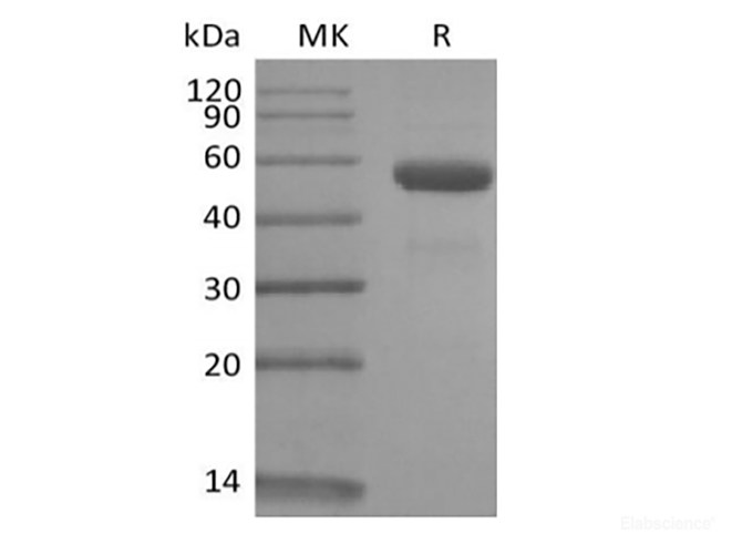Recombinant Rhesus Macaque CD79B/B29 (C-Fc)