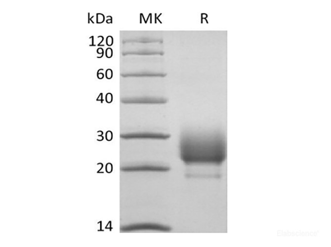Recombinant Rhesus Macaque CD79B/B29 (C-6His)