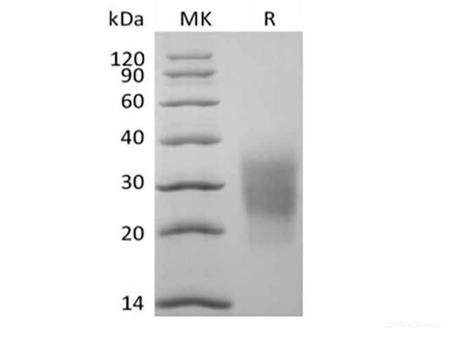 Recombinant Cynomolgus NKG2-D type II Integral Membrane Protein/NKG2D/CD314 (N-6His)