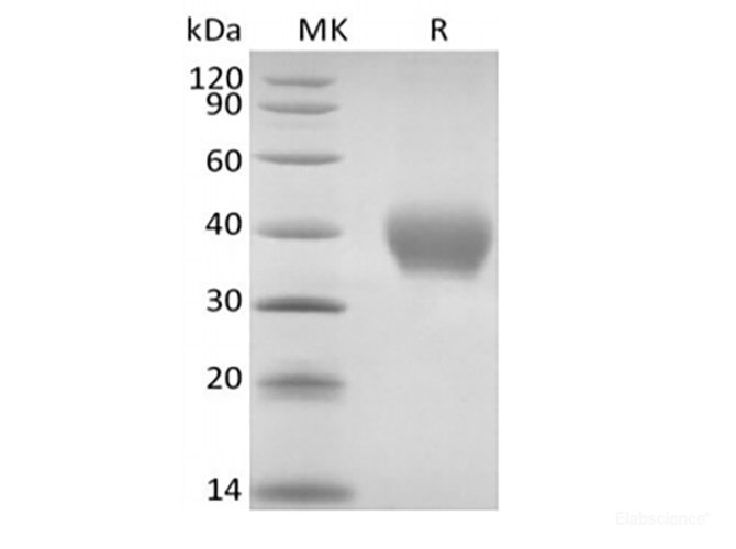 Recombinant Rhesus Macaque TNF Receptor II/TNF RII/TNFRSF1B/CD120b  (C-6His)