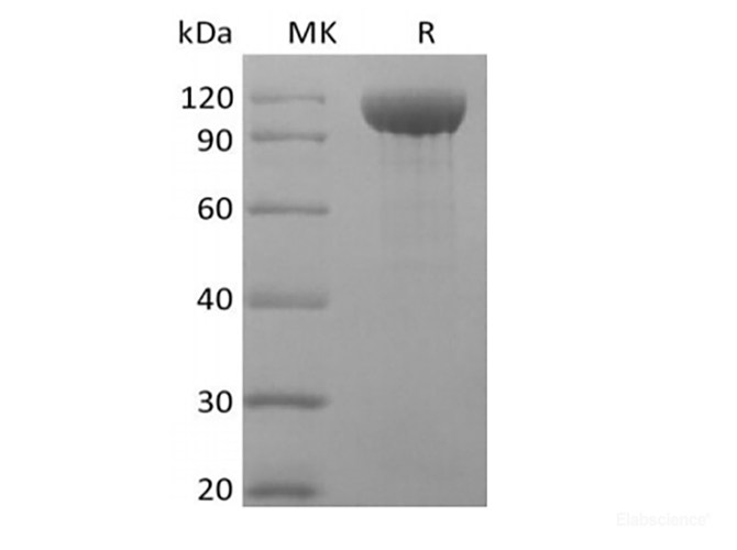 Recombinant Rhesus Macaque Angiopoietin-2/ANG2 (C-Fc)