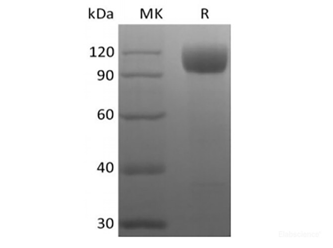 Recombinant Rhesus Macaque Angiotensin-Converting Enzyme 2/ACE-2 (C-10His)