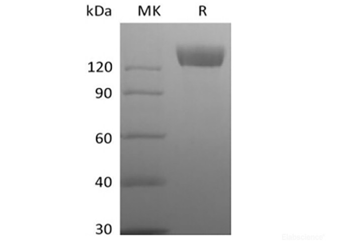 Recombinant Rhesus Macaque Angiotensin-Converting Enzyme 2/ACE-2 (C-Fc)