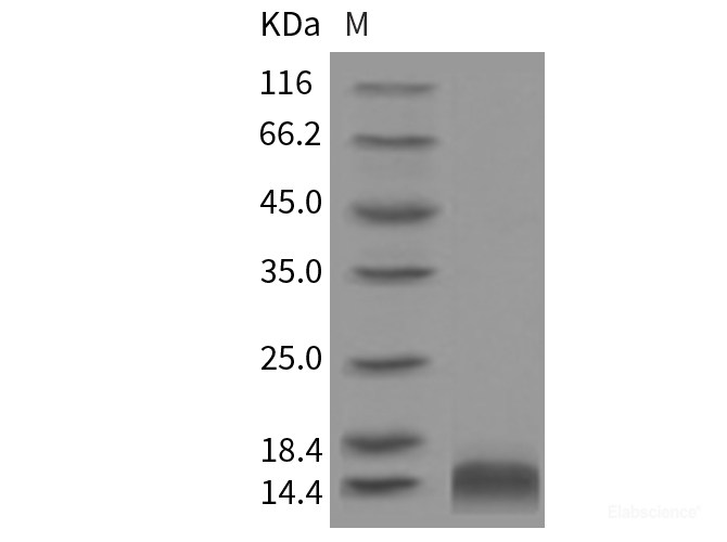 Rat CCL4 / MIP1B Protein(His Tag)-Elabscience