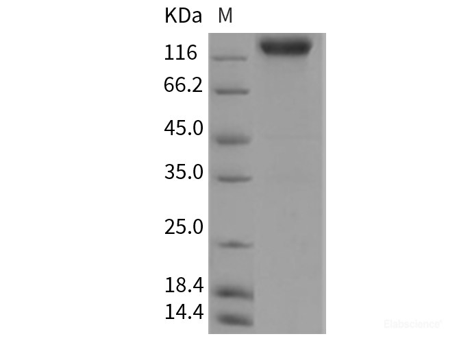 Recombinant Rat VEGFR2 / Flk-1 / CD309 / KDR Protein (Fc tag)-Elabscience