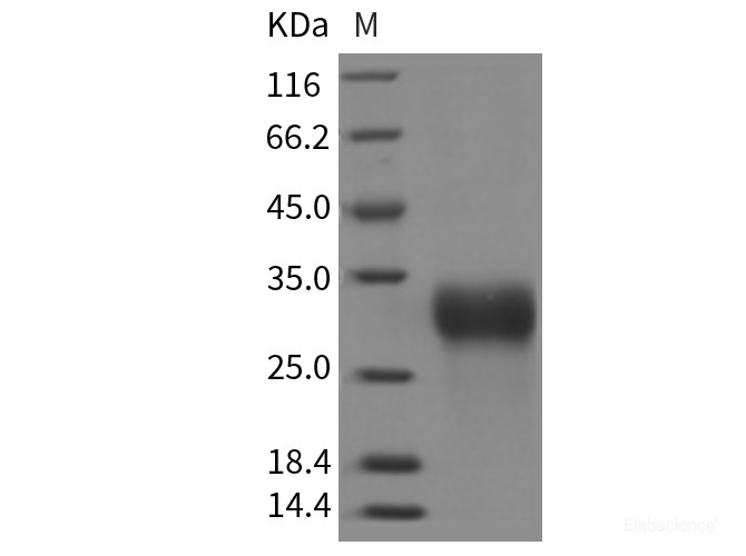 Recombinant Rat IGFBP6 / IBP6 Protein (His Tag)-Elabscience