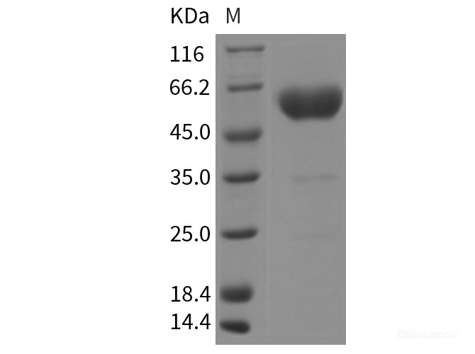 Recombinant Rat Podoplanin / PDPN Protein (ECD, Fc Tag)-Elabscience
