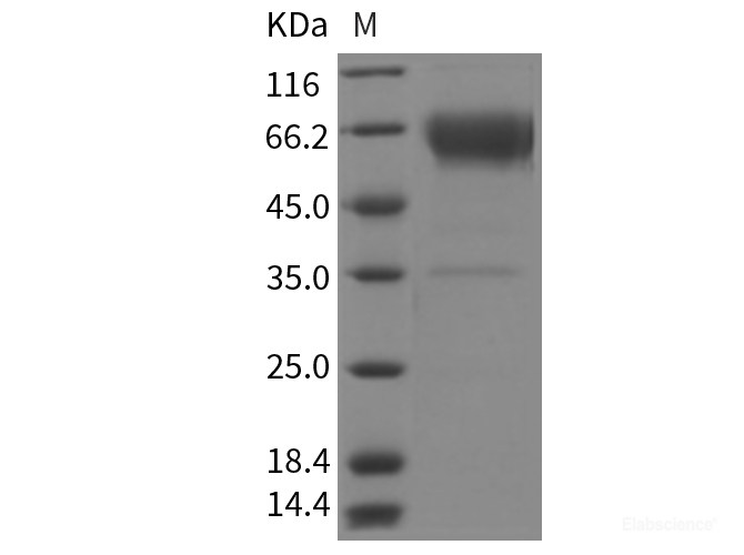 Recombinant Rat BTLA Protein (ECD, Fc tag)-Elabscience