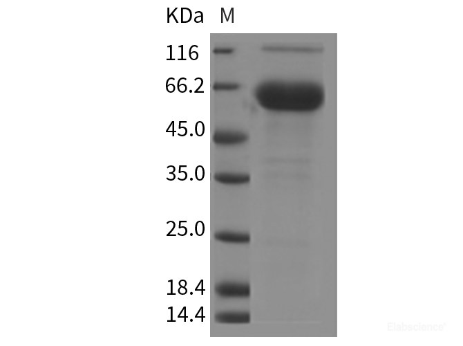 Recombinant Rat FOLR1 / Folate Receptor 1 Protein (Fc tag)-Elabscience
