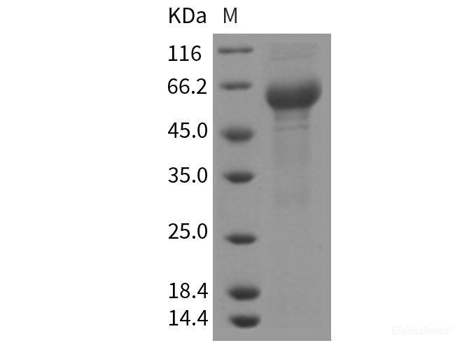 Recombinant Rat IL-6R / CD126 Protein (ECD, His tag)-Elabscience