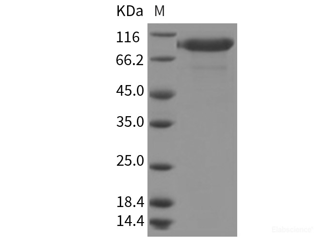 Recombinant Rat IL-6R / CD126 Protein (Fc tag, ECD)-Elabscience