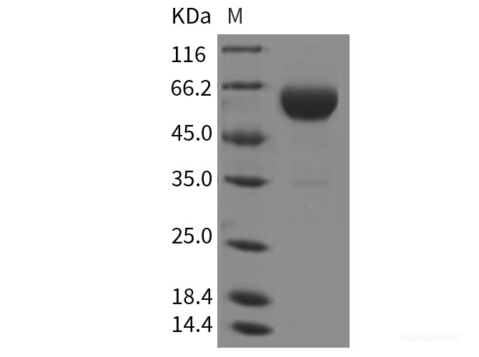 Recombinant Rat Carboxypeptidase B2 / CPB2 Protein (His Tag)-Elabscience