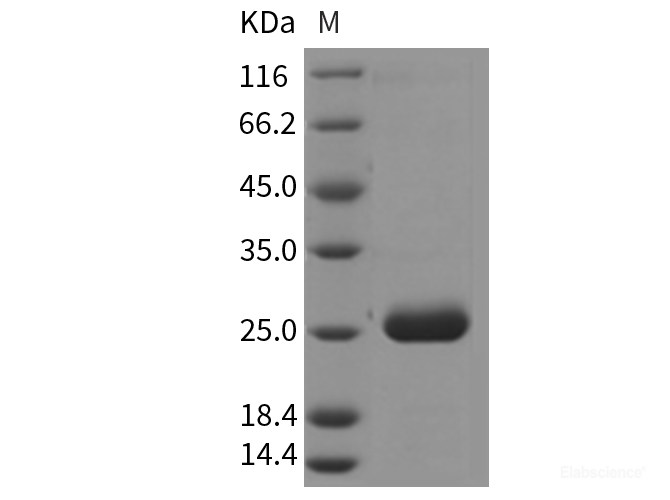 Rat PRL2A1 / Prolactin-2A1 Protein (His Tag)-Elabscience