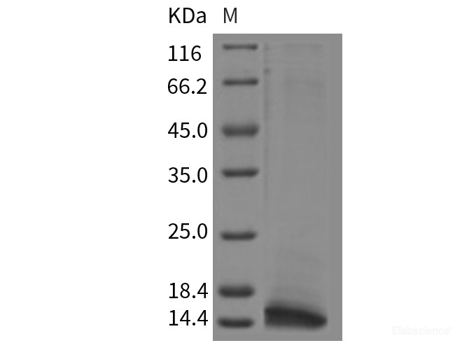 Recombinant Rat CLPS / Colipase Protein (His Tag)-Elabscience