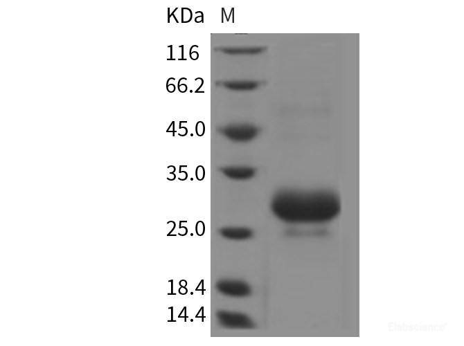 Rat CTHRC1 Protein (His Tag)-Elabscience