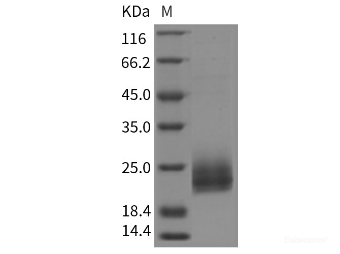 Rat Niemann-Pick disease type C2 / NPC2 Protein (His Tag)-Elabscience