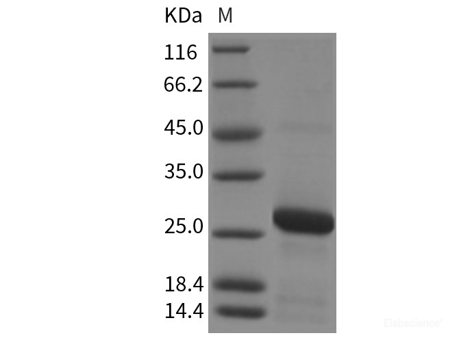 Recombinant Rat RAB7A / Rab-7a Protein (His tag)-Elabscience