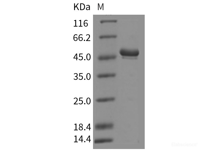 Recombinant Rat SerpinF1 / PEDF Protein (His Tag)-Elabscience