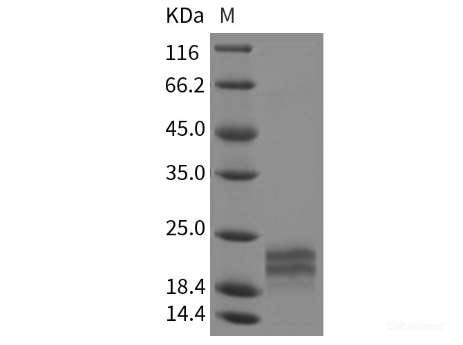 Recombinant Rat IL17F / IL-17F Protein (His tag)-Elabscience