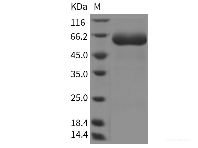 Rat IL-22R / IL22RA1 Protein (ECD, Fc Tag)-Elabscience